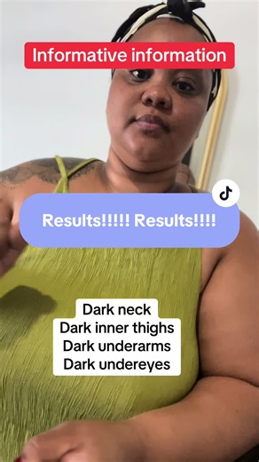 Hyperpigmentation Update: Achieve Clear, Glowing Skin