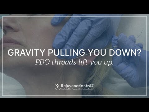 Get a Snatched Jawline with PDO Threads