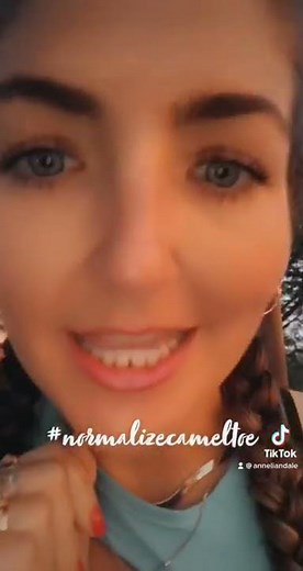 Normalize camel toes