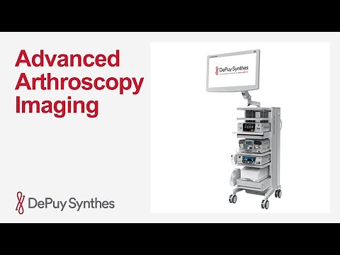 VUE Arthroscopic Tower with PUREVUE 4K Visualization System Overview | DePuy Synthes