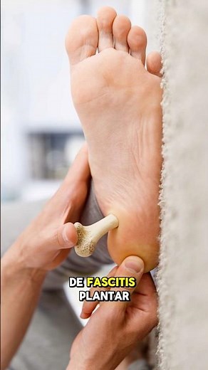 The TRUTH about HEEL SPURS and PLANTAR FASCIITIS