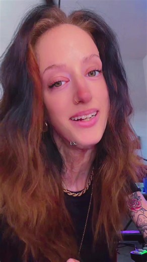 Understanding Dog Reactivity and Managing Behavior