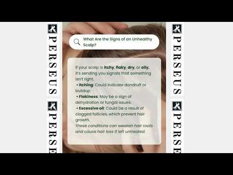 Signs of an Unhealthy Scalp & How to Fix It Naturally