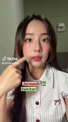 Posisi Jerawat dan Penyebabnya: Mengapa Jerawat Muncul di Dagu dan Pipi