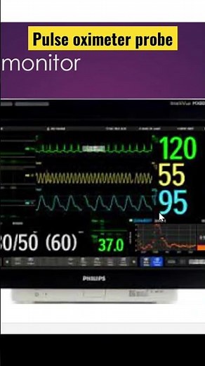 Pulse oximeter probe-saturation monitoring in NICU #nicu #neonatal #neonatology #saturation #oxygen