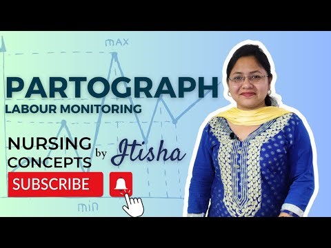 PARTOGRAPH | LABOUR PROGRESS | HOW TO FILL A WHO PARTOGRAPH | EASY WAY TO PLOT | ITISHA ROSE PRASAD