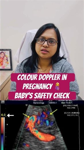 Colour Doppler = Baby’s blood flow check 🩺💓simple scan, big reassurance #colordoppler #momtobe