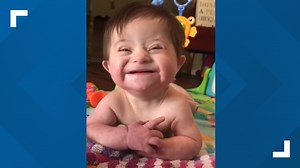 A smile to remember: Video of adopted baby with Down syndrome goes viral