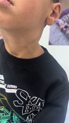 Çocuklarda Lenf Nodu Büyümesi Nedenleri ve Belirtileri