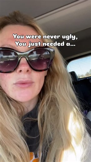 Healing after separation isn’t linear — some days you’ll feel strong, other days you’ll cry in the car and wonder if you’re going backwards. You’re not. You’re rebuilding. 💫 Being kind to yourself after a breakup or separation isn’t weakness — it’s how you learn to stand again. So breathe, slow down, and remember — your peace is your comeback story. 🤍 Ps: No one is ever ugly, this is a visual representation of finding yourself again. #HappyMamaEdit #SoloParenting #HealingJourney #SeparationRec