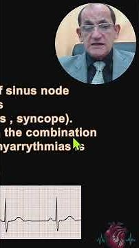 Sick Sinus Syndrome (8)