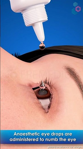 Laser Photocoagulation ↪ 3D Medical Animation #eyes #retinal #eyedisease