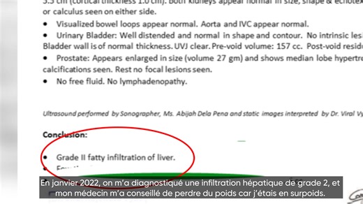 14 reactions | ☕ Découvrez la véritable puissance du Edmark Café...