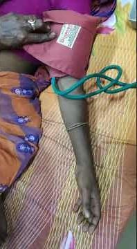 Demonstration of TROUSSEAU's SIGN