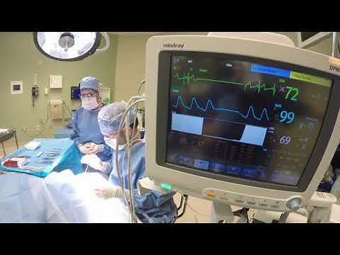 The Oculocardiac Reflex: A Review - Video abstract [ID 317447]