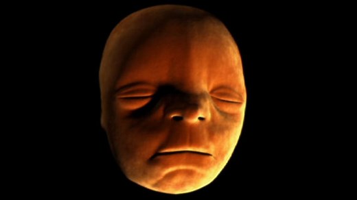 Facial development in womb