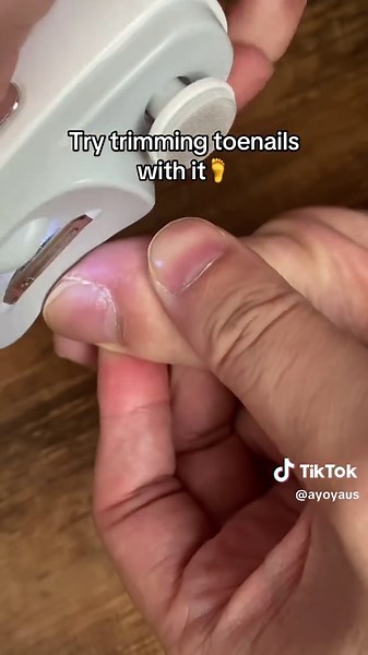 Trimming Toenails with an Electric Nail Clipper