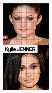 763K views · 3.6K reactions | @kyliejenner : ses opérations de chirurgie esthétique ont-elles été réussies ? Décryptage ! | Docteur Michel Boksenbaum - Médecine esthétique | Facebook