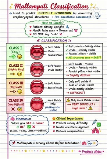 mallampatii classification
