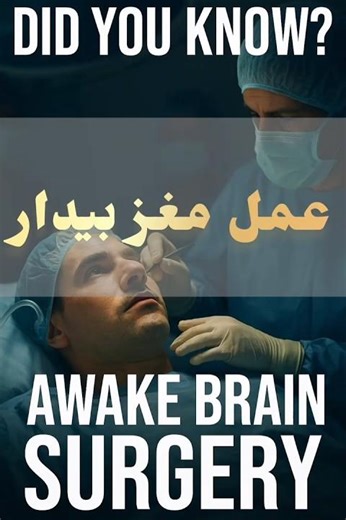 🧠 عمل جراحی مغز در حالی که بیمار بیدار است!😳Awake Brain Surgery Explained #facts #factonic #دانستنی
