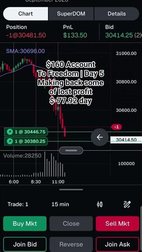 MNQ | TRAP AND SHIFT | SMALL LOST ON THE DAY