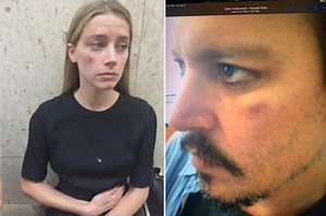 Amber Heard says honeymoon photo of Johnny Depp with 2 black eyes 'photoshopped'