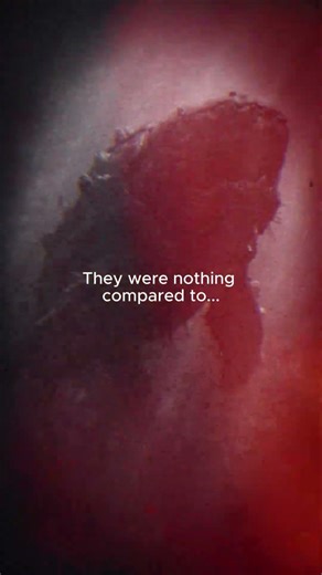 The Fish With a Bone Guillotine Jaw... ⚔️💀