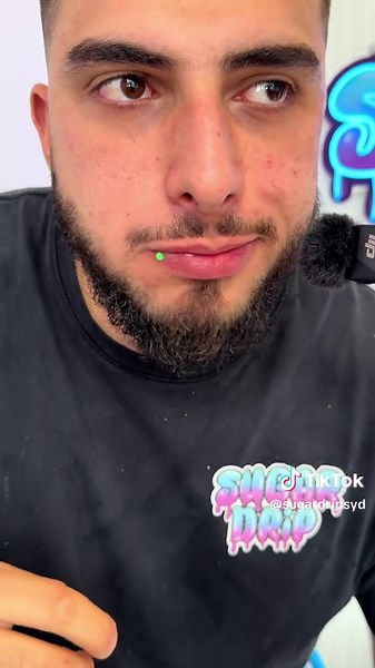 Frozen Desserts: How Sugar Drip Transforms Desserts