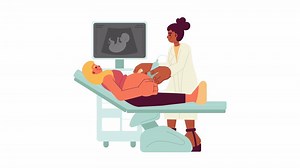 Fetal ultrasound cartoon animation. New mom pregnancy diagnostic imaging 4K motion graphic. Sonogram nurse scanning pregnant woman womb animated 2D characters isolated on white background