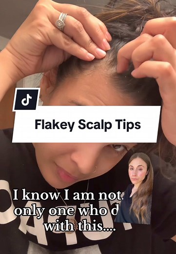 Dry Scalp Care Tips for Flaky Skin Relief