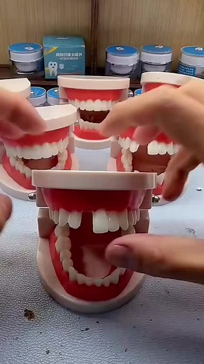 Chipped Tooth Repair: A Complete Guide