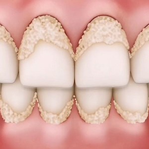 Food videos😋 | Your smile DOES matter! 😍 Our INTENSIVE stain removal toothpaste is the newest way to brighten your smile using baking soda for deep... | Instagram