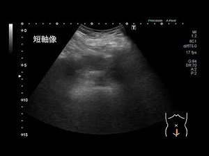 尿道（女性骨盤腔）