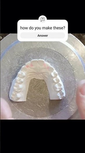 adding teeth to essix retainer #orthodontics #essix