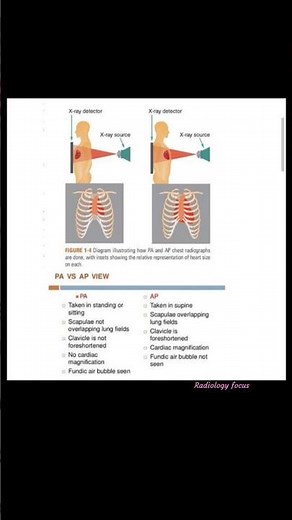 Chest AP and PA X ray Difference