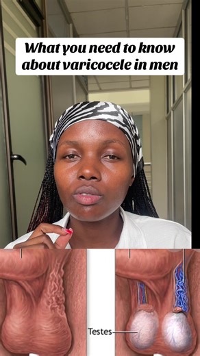 Understanding Varicocele Symptoms in Men