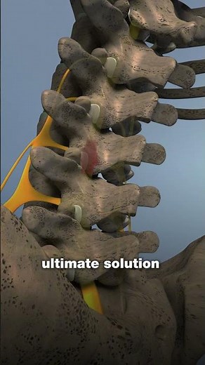 Inversion Table Protocol: The Step-by-Step Guide That Works