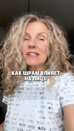 How a scar affects the face #healthybody #facemassage #exercisesathome