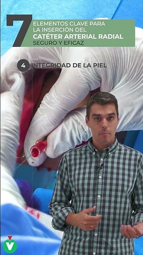 7 elementos clave para la inserción del catéter arterial radial