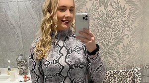 I was dismissed as being ‘hormonal’ for YEARS - now I have a colostomy bag at 25