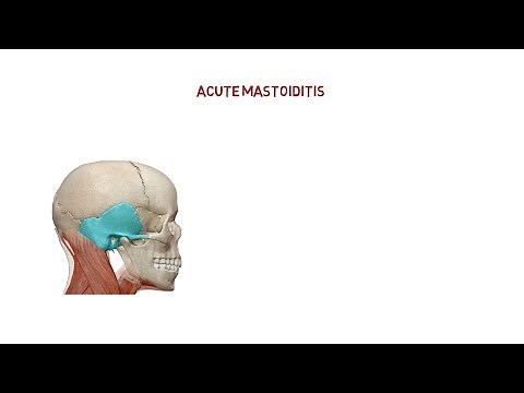 Acute mastoiditis | pathology | etiology | clinical features |treatment | complication