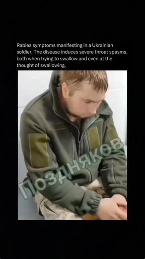 SCARY MEMES on Instagram: "Rabies symptoms manifesting in a Ukrainian soldier illustrate the advanced neurological stage of a viral infection transmitted through the saliva of infected animals, most often via bites. Once the virus reaches the central nervous system it disrupts brain function and triggers intense involuntary muscle contractions. The disease induces severe throat spasms both when trying to swallow and even at the thought of swallowing, a hallmark feature that leads to hydrophobia