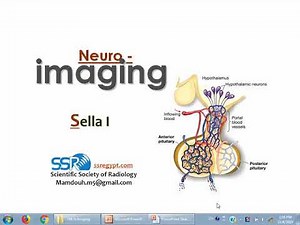 1 Imaging of sella (part 1) - prof.Mamdouh Mahfouz (2019 edition)