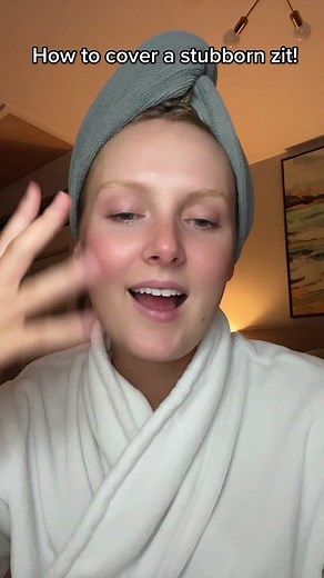 How to Conceal Difficult Acne | Makeup Tips & Tutorial