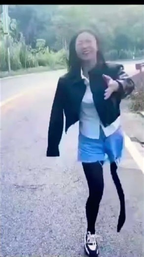 amputee women #dak #funny #funny #nevergiveup #love #duet #movie #disabilityawareness #inspiration