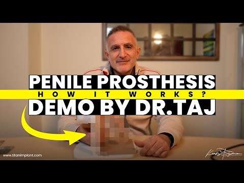 How Does a Penile Prosthesis Work? Dr. Taj Explains with a Live Demo!