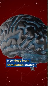 New Advances in Deep Brain Stimulation Treatment for Parkinson's