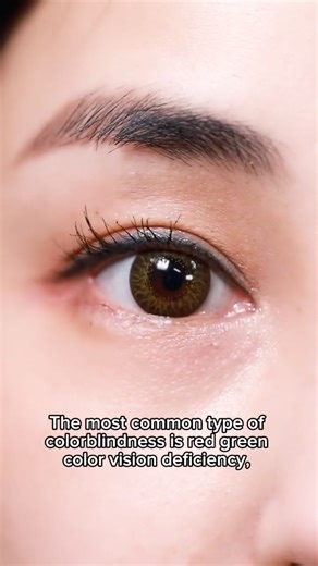 Colorblindness #science #sciencefacts #eyes