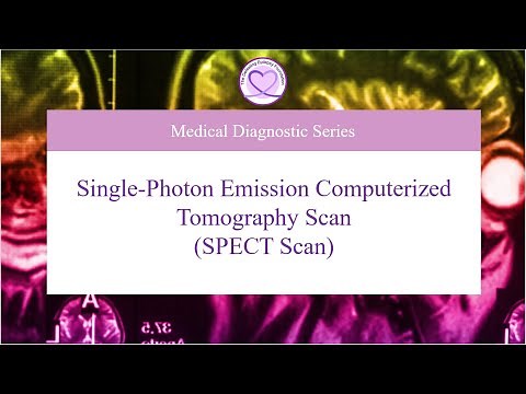SPECT Scan