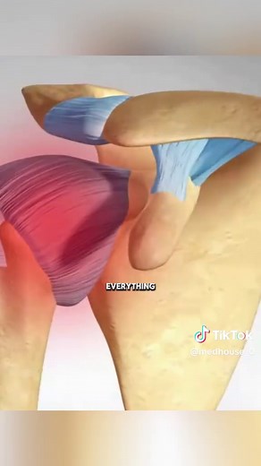 Exploring Frozen Shoulder: Causes and Treatments Explained